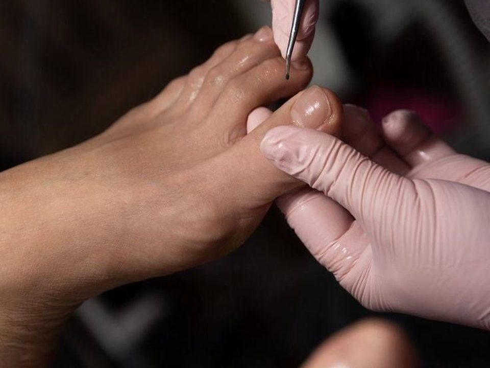 Pedicuria en Trisquel