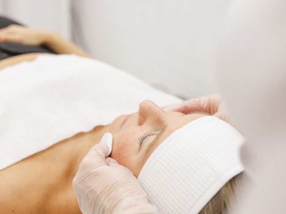 Peeling facial en Trisquel